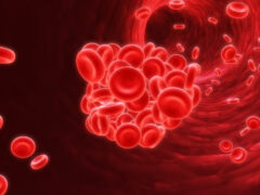 Blood clot