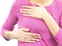 Breast Cyst