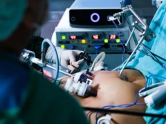 Gastric bypass