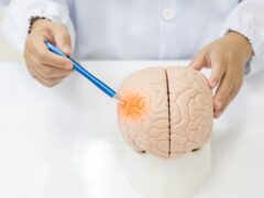 Neurologist hand pointing brain anatomy human model and brain disease lesion on white background.Part of human body model with organ system for health student study in university.Brain model.