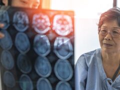 Brain disease diagnosis with medical doctor diagnosing elderly ageing patient neurodegenerative illness problem seeing Magnetic Resonance Imaging (MRI) film for neurological medical treatment